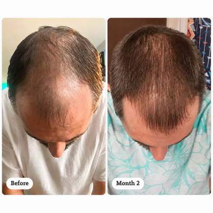 Korean Herbal Scalp Revival Bar