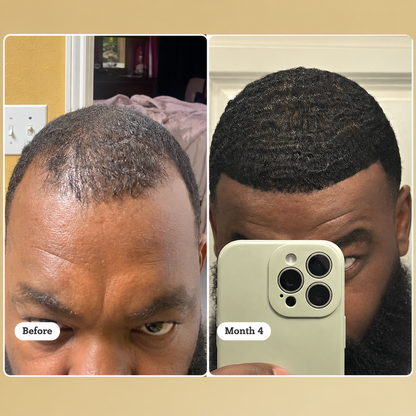 Korean Herbal Scalp Revival Bar