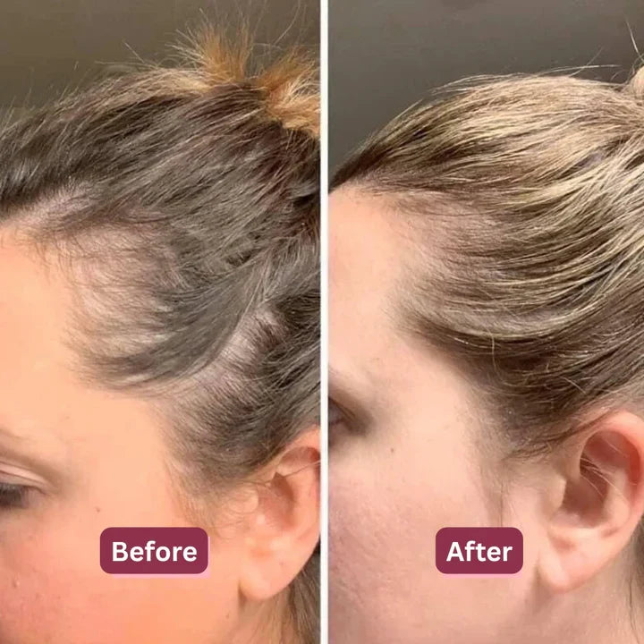 Korean Herbal Scalp Revival Bar