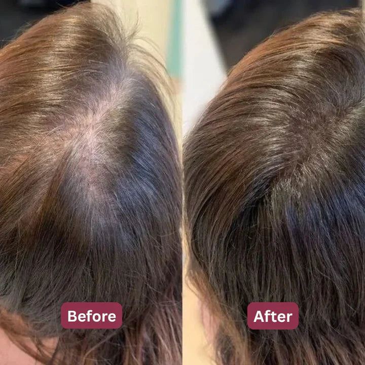 Korean Herbal Scalp Revival Bar