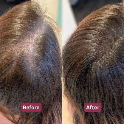 Korean Herbal Scalp Revival Bar