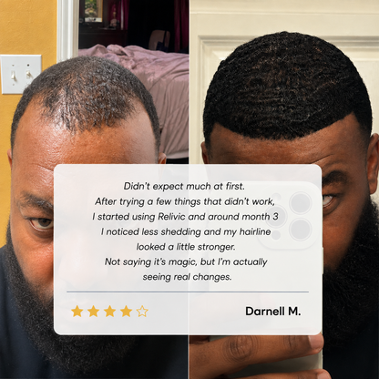 Relivic™ Hair Growth Serum Roll-On