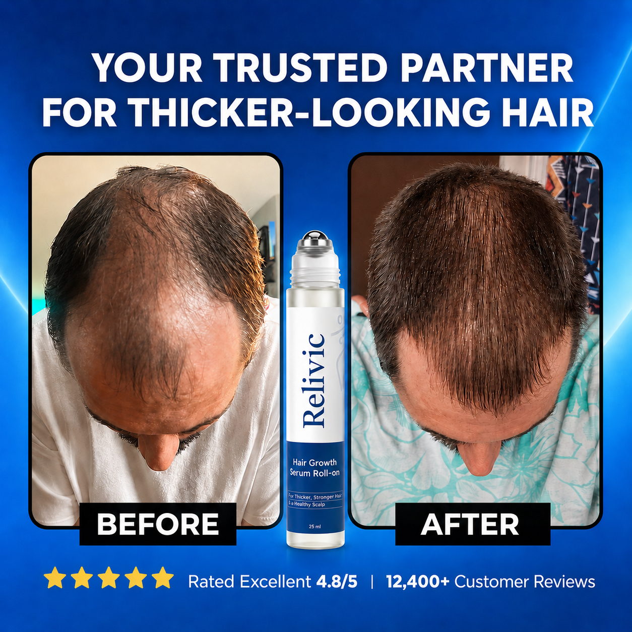 Relivic™ Hair Growth Serum Roll-On